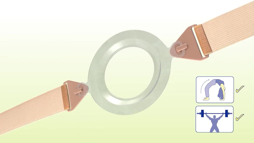 Stoma Care products and Ostomy Supplies